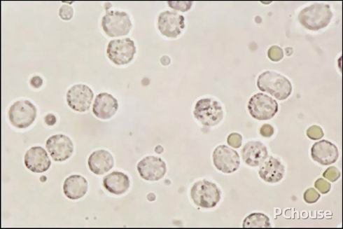 白细胞低的原因 白细胞低的原因及危害