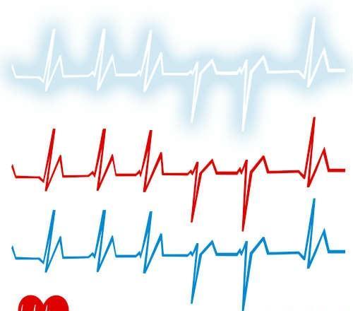 脉搏和心跳 脉搏和心跳不一致是怎么回事