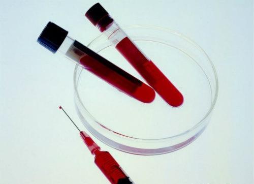 新鲜冰冻血浆的作用 血浆的作用