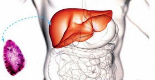 肝囊肿的治疗方法 肝囊肿的治疗