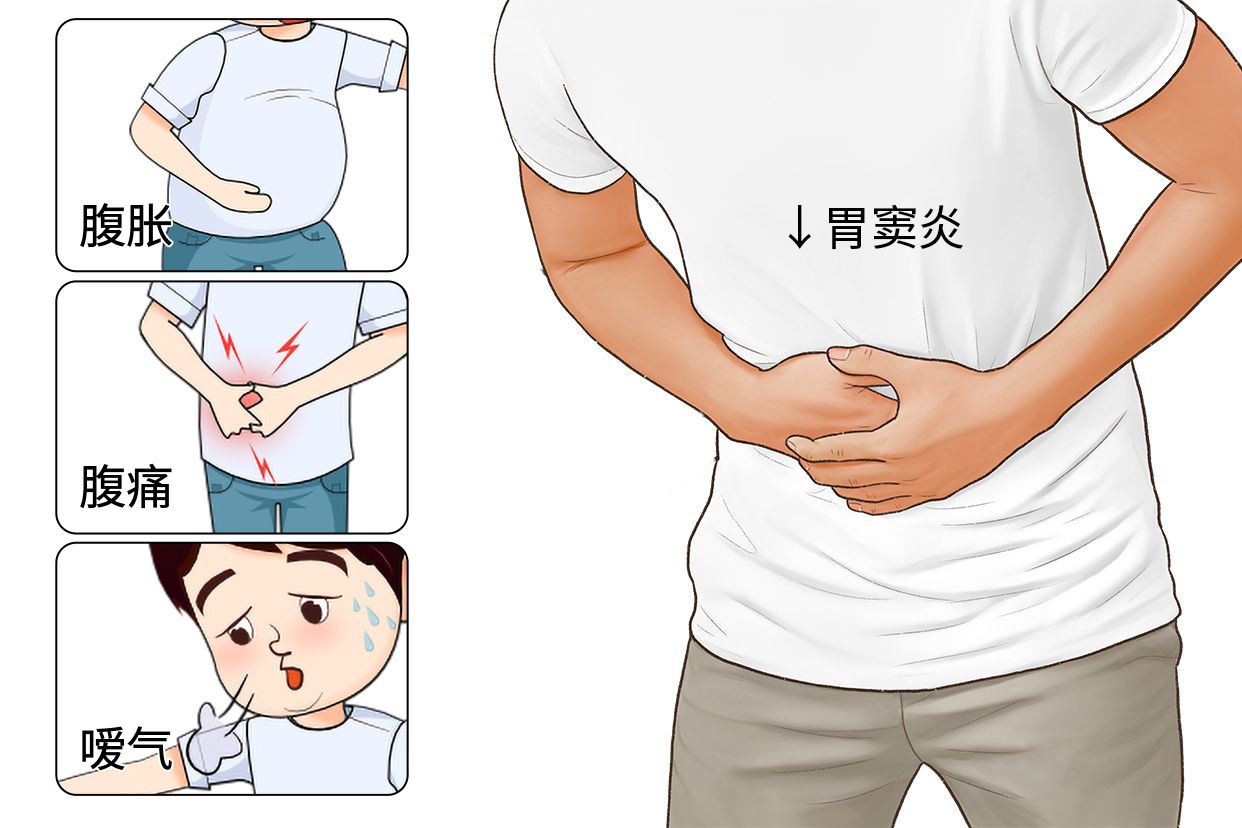 胃窦炎是什么症状图片（胃窦炎有哪些常见症状）