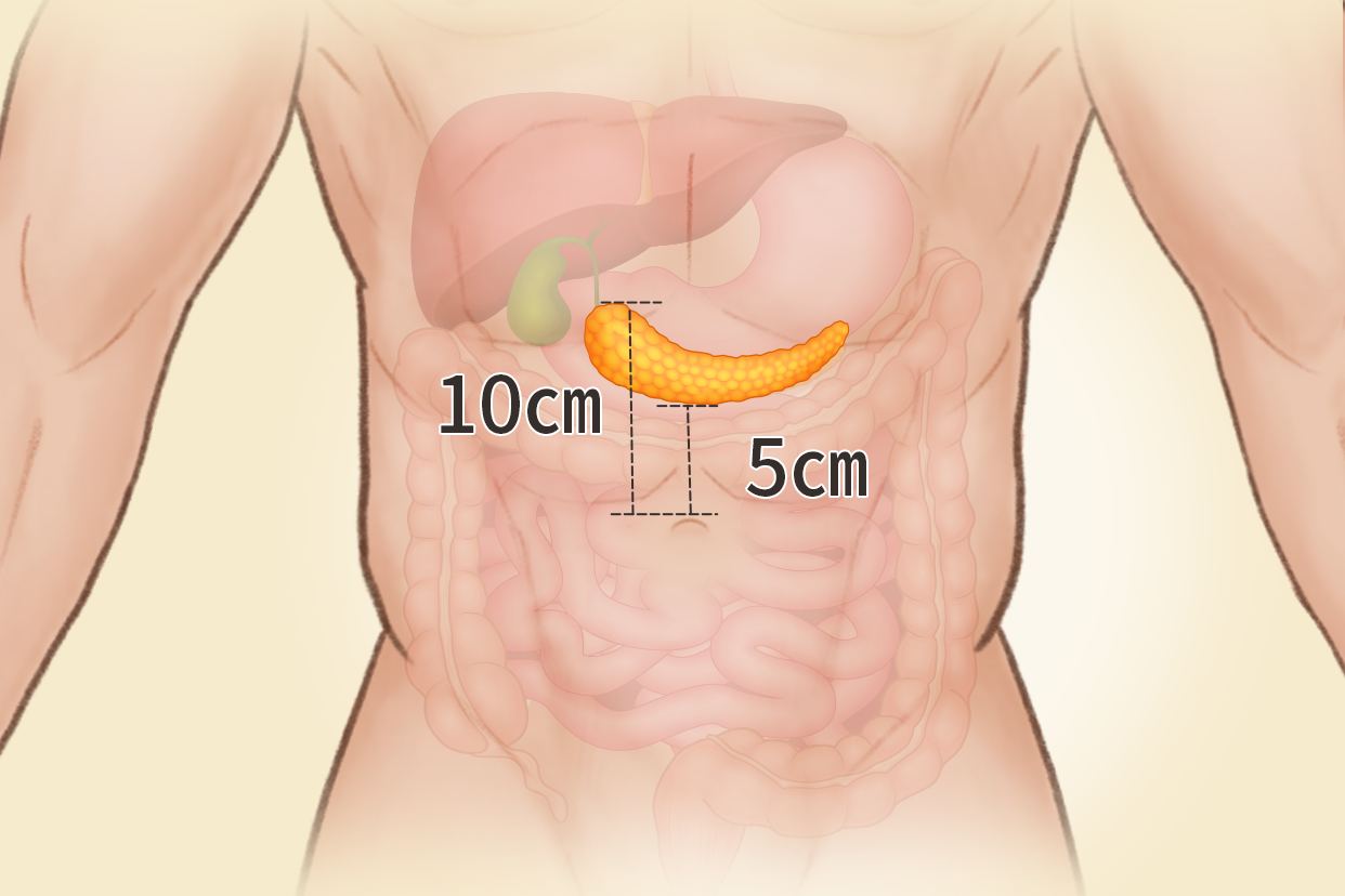 胰腺体表投影区位置图（胰腺体在哪个位置图）