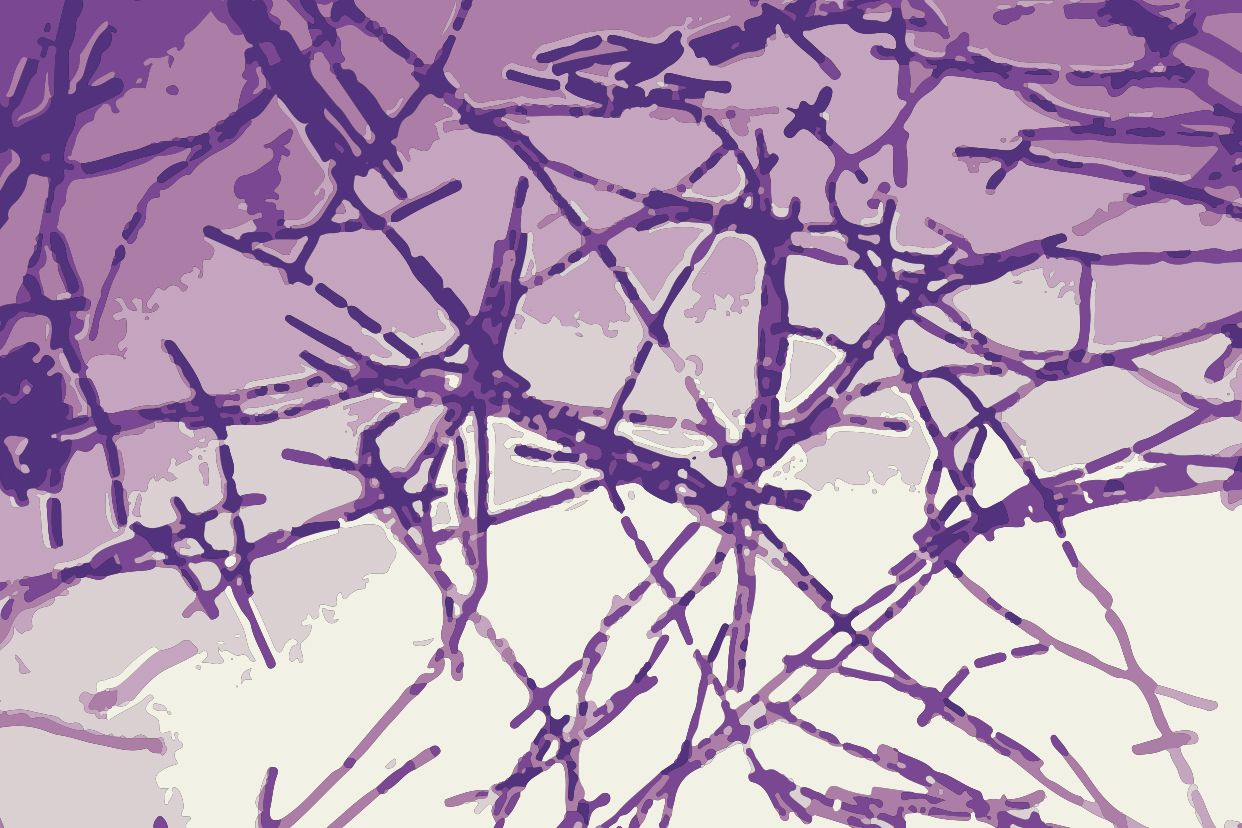 炭疽杆菌光镜图 炭疽杆菌镜下图片