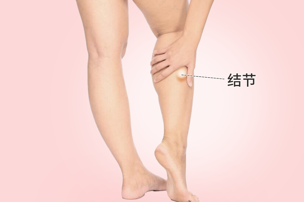 小腿外侧有结节是怎么回事 女人右小腿外侧结节图片