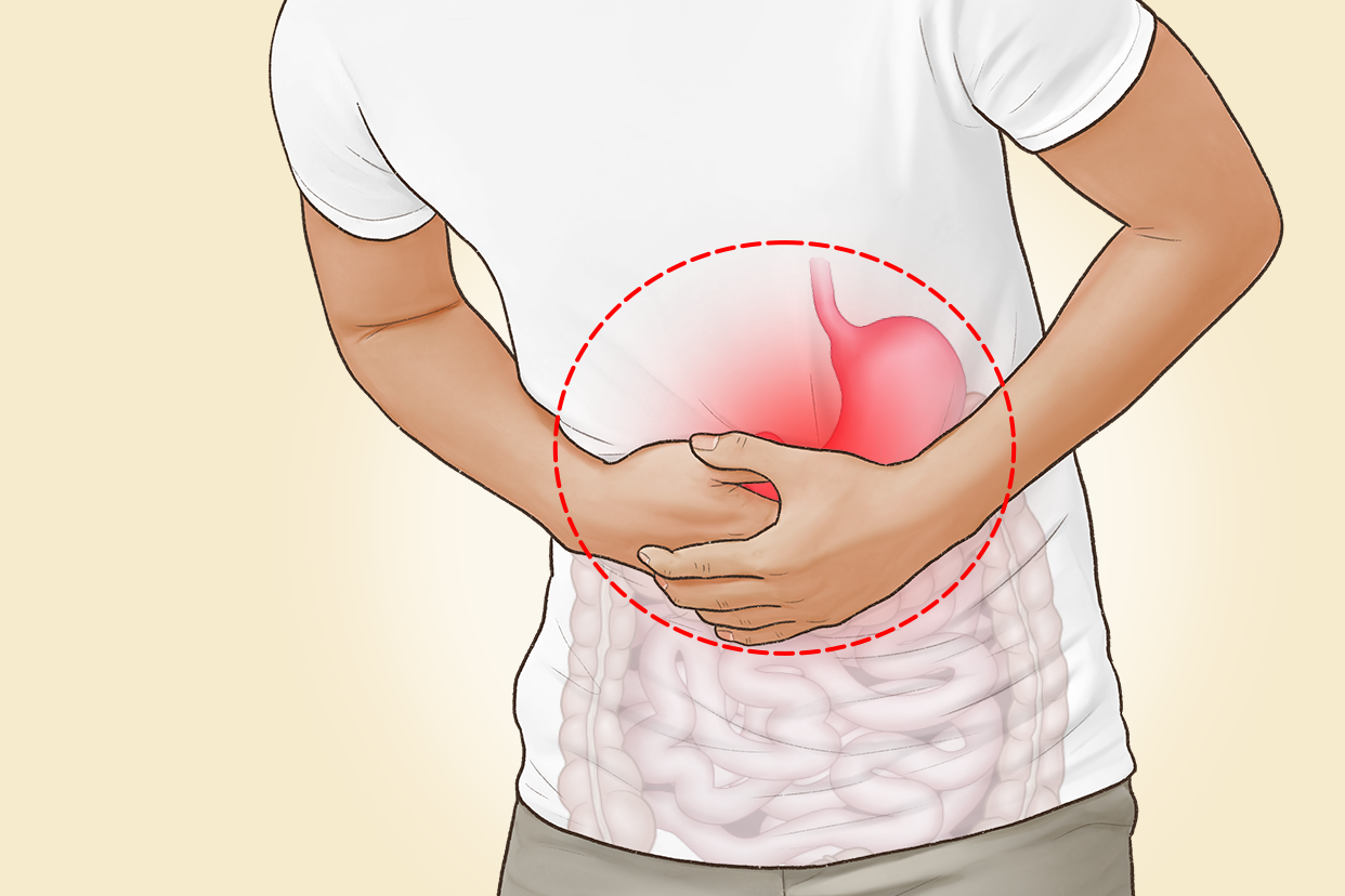 慢性浅表性胃炎图片大全 慢性浅表性胃炎图片