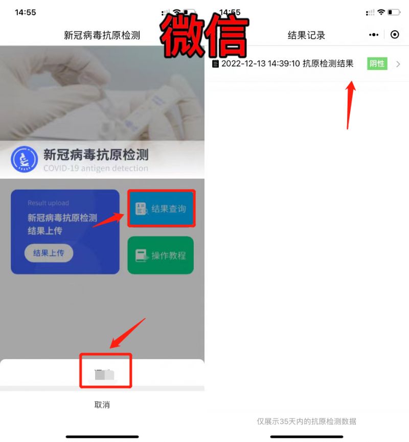 重庆抗原结果上传流程+入口