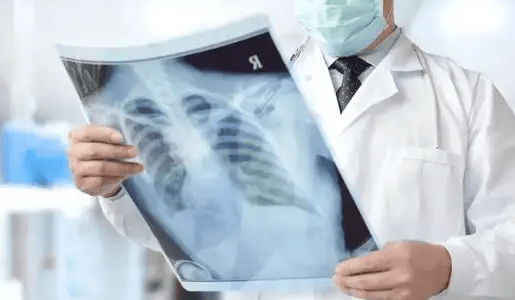 关于“白肺”，我们已知和未知的 什么是白肺