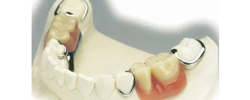 活动假牙咀嚼力能恢复多少 戴假牙吃东西咀嚼力如何