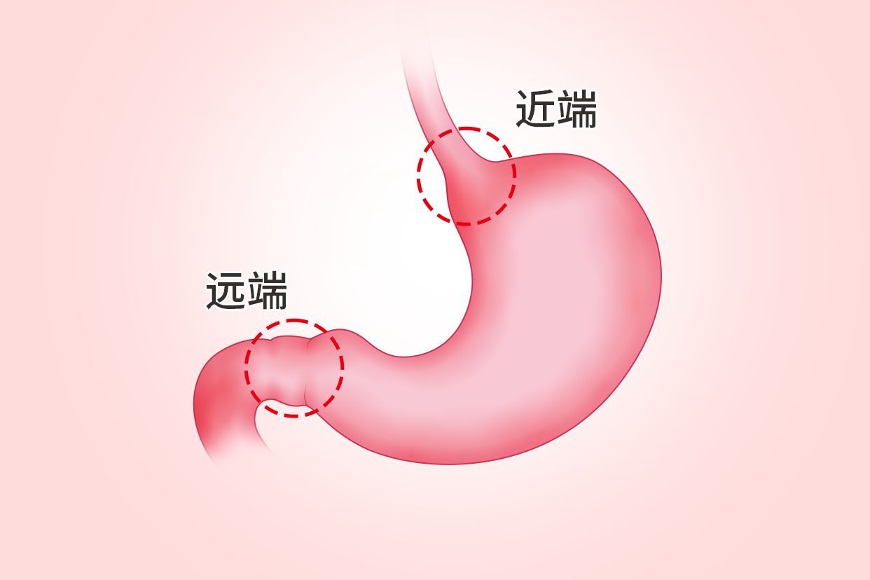 胃远端与近端的区别图 胃远端和近端的区别
