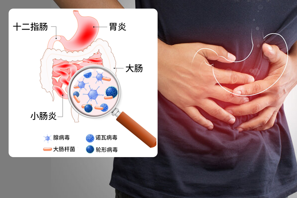 急性胃炎图片（急性胃炎图片大）
