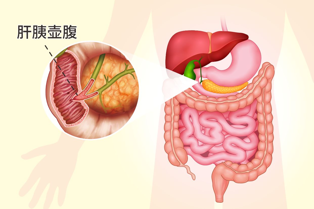 肝胰壶腹部在哪个位置图片（肝胰壶腹部开口于哪里）