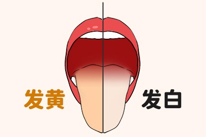 舌苔厚白和厚黄的区别图片 舌苔厚白和厚黄的区别图片大全
