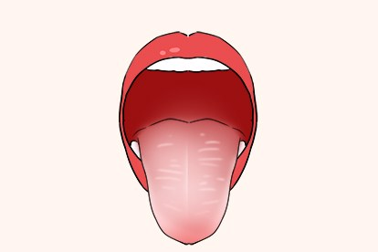舌红苔白图片（舌红 苔白）
