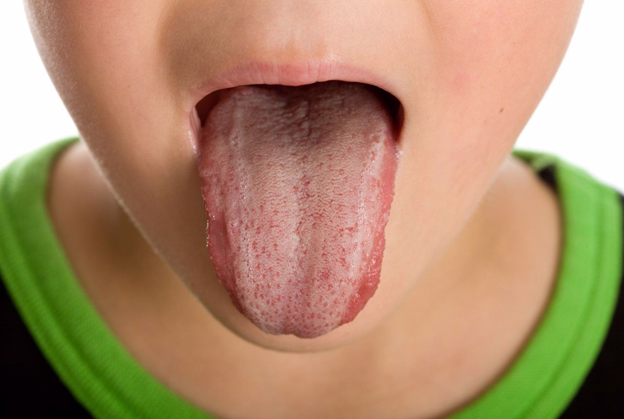 舌头上两边两条竖线图片（舌头上两边两条竖线图片大全）