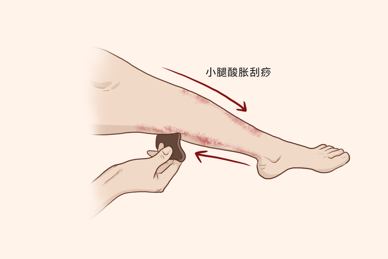 小腿酸胀刮痧的方法示意图 小腿刮痧的正确方法视频教程