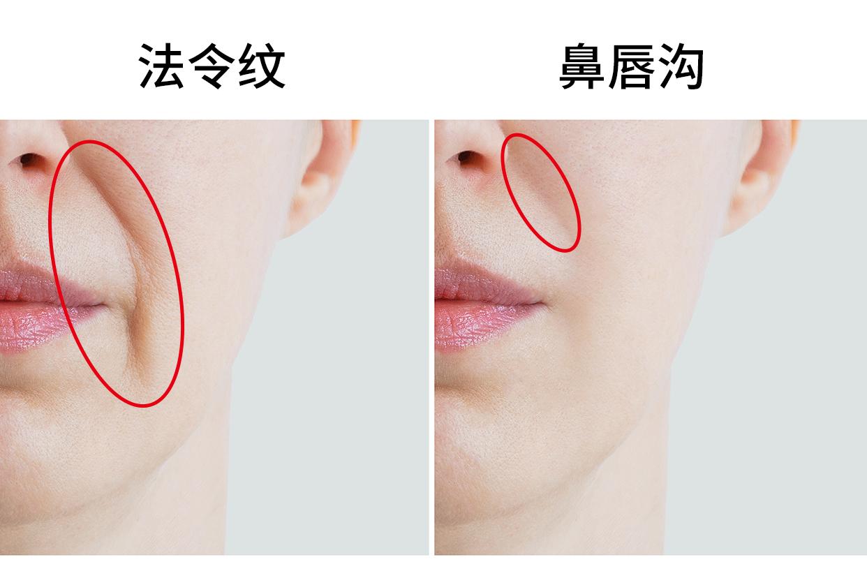 法令纹和鼻唇沟的区别图片（法令纹与鼻唇沟的区别）