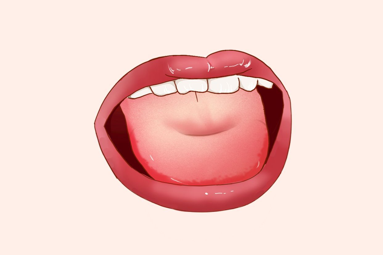 痿软舌图片（痿软舌常见原因）