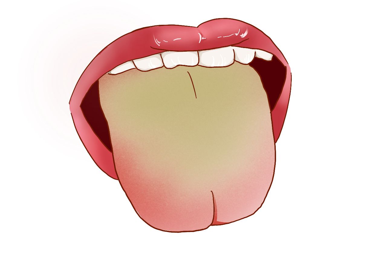 膀胱湿热舌苔图片