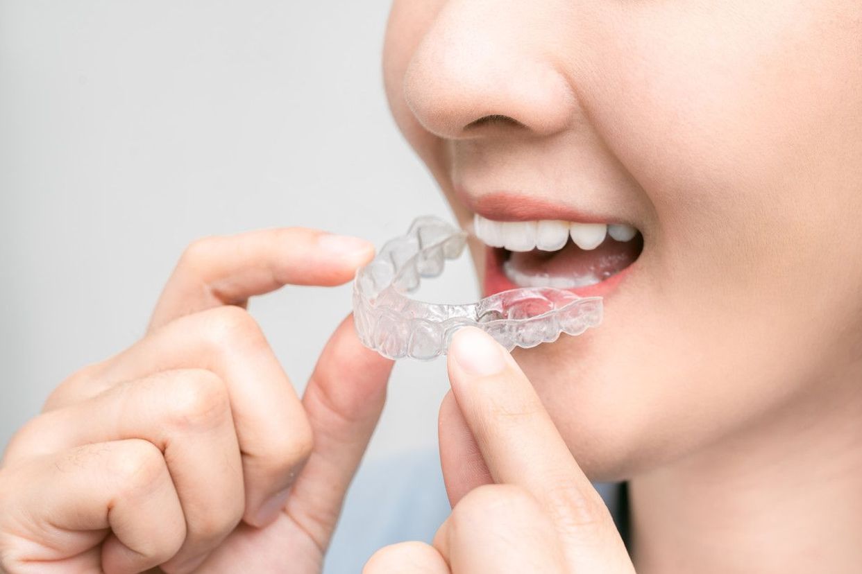 牙釉质透明照片