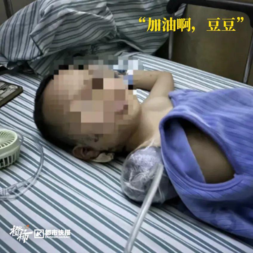 邻居小伙炮仗随手扔，江西7岁男孩被炸伤永失右臂！他在杭州已住院14天，动过两次手术……