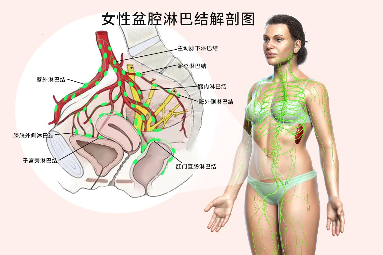 女性盆腔淋巴结解剖图 女性盆腔淋巴结解剖图片大全