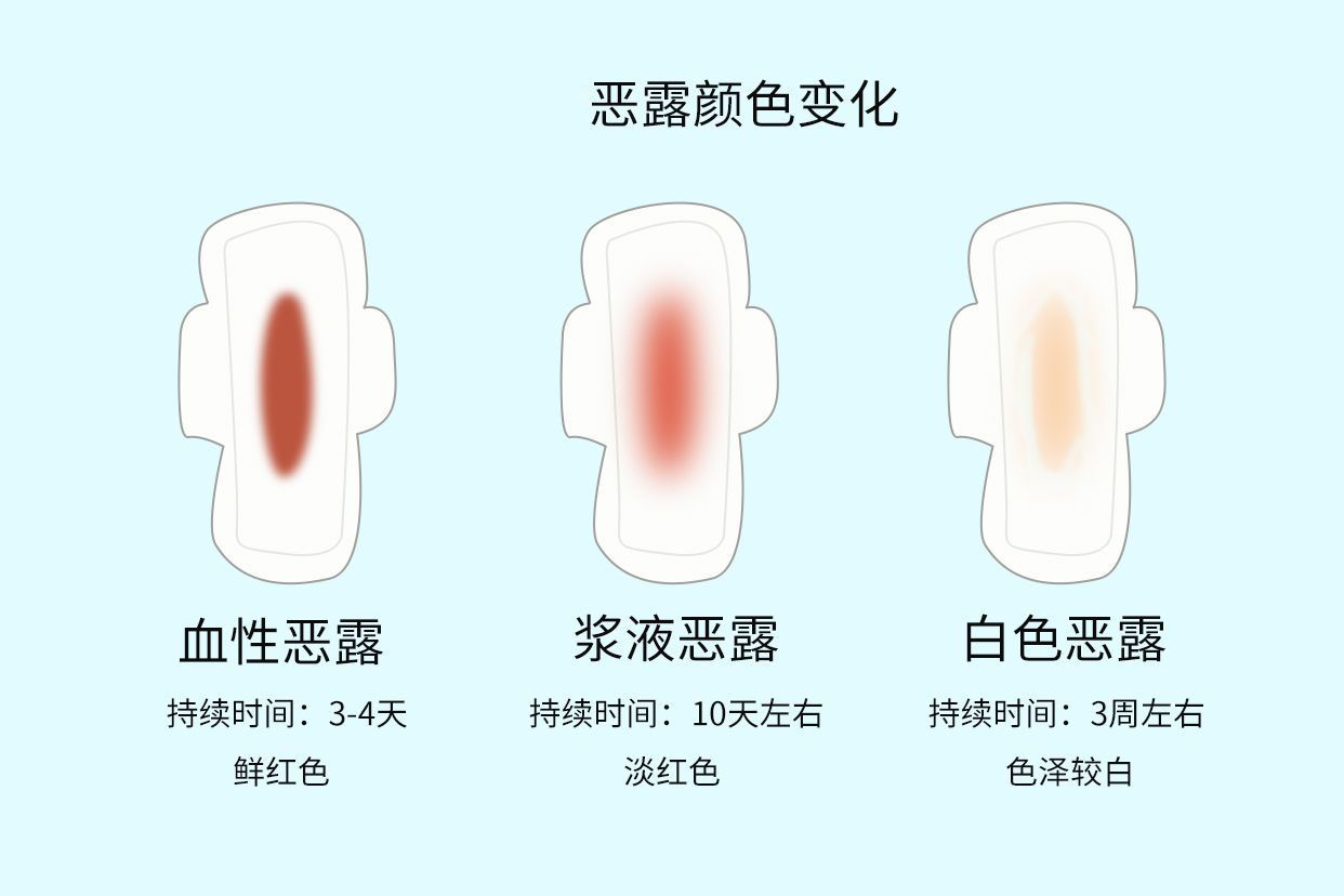 产后分泌物图片（产后分泌物很多怎么回事）