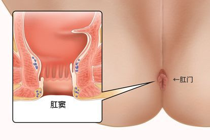 肛窦解剖图（肛窦结构图）