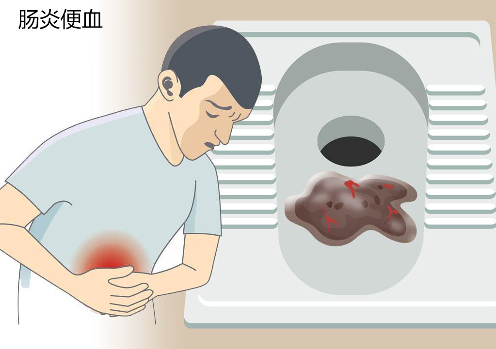 肠炎便血图片