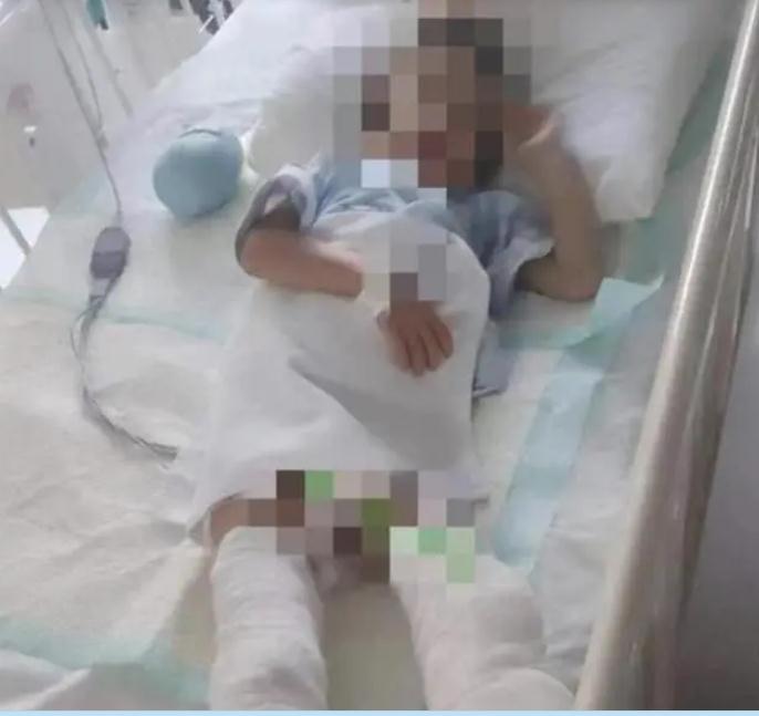 江苏6岁男童被生母虐待致双腿截肢案将开庭 男童父亲：孩子已安装假肢 不愿意提妈妈